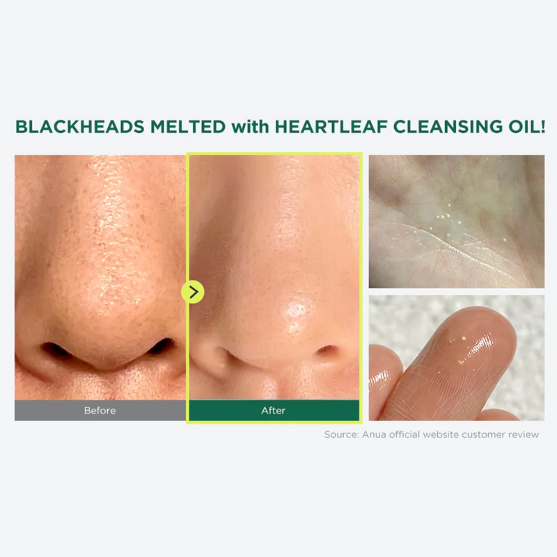 Anua Heartleaf Pore Control Cleansing Oil Skincare
